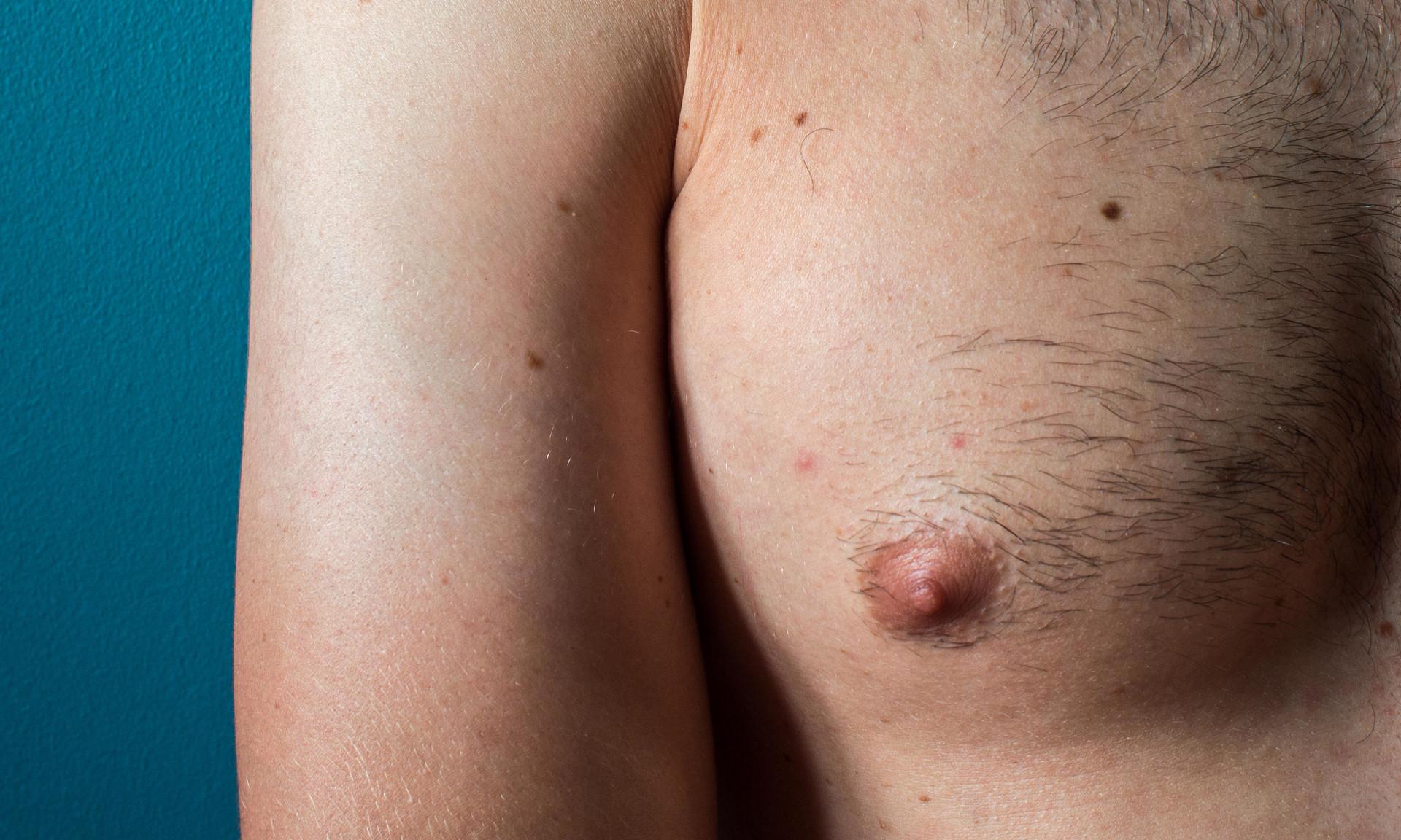 Как меняется женская грудь. Особенности и факторы влияния