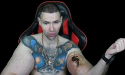 Блогер Руки-Базуки может лишиться конечностей: Кириллу Терешину грозит ампутация