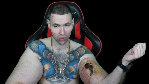 Блогер Руки-Базуки может лишиться конечностей: Кириллу Терешину грозит ампутация