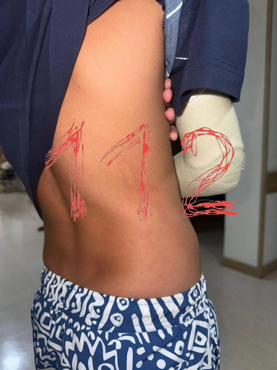 Травмы мальчика | Источник: 112 / t.me