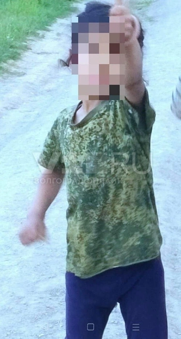 Девочка упала и сломала колено | Источник: отец девочки