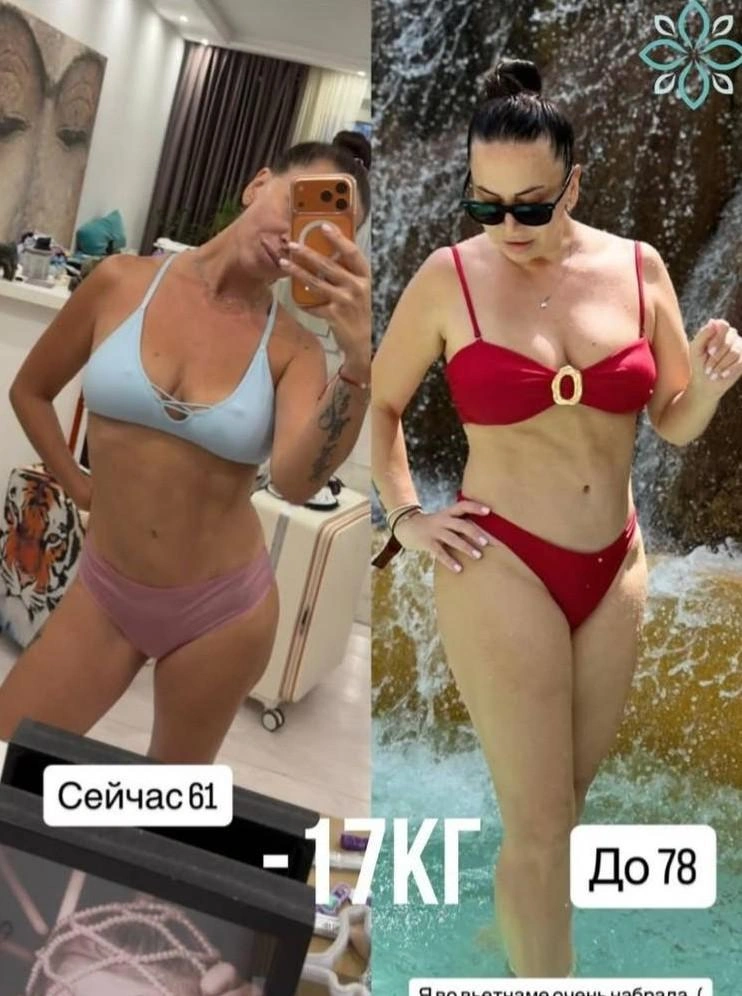 Наталья Фриске похудела на 17 кило и столкнулась с эстетическими проблемами после пластики | Источник: Natalia Friske / T.me