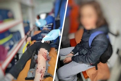 Нападение собак на подростков в Норильске: дети госпитализированы