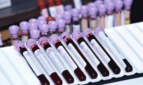 В США испытали генную терапию ВИЧ-инфекции