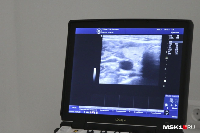 ИИ способен обнаружить патологии, которые может не заметить врач | Источник: Татьяна Спиридонова / MSK1.RU