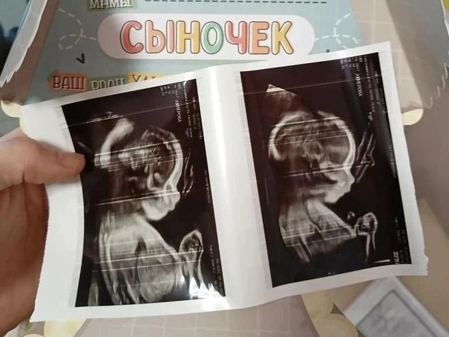 Мерседес вот-вот родит: предварительная дата — 19 августа | Источник: читатель E1.RU Сергей