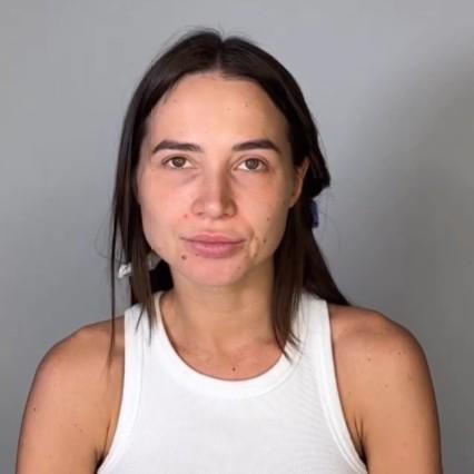 Рыдает в голос, кричит, что некрасивая, и отрезает свои волосы: больная раком Лерчек побрилась налысо