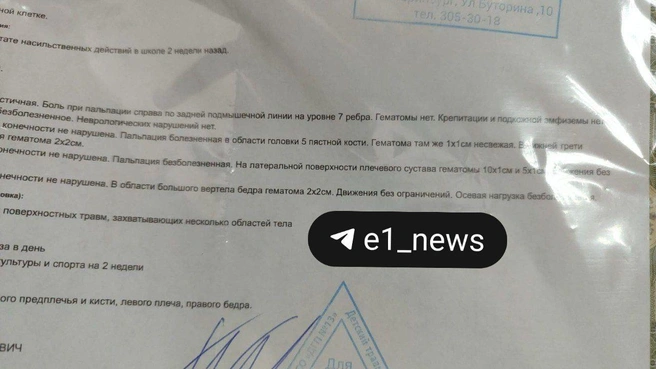 После последнего случая мама с сыном обратились в больницу, где у мальчика сняли побои  | Источник: читательница E1.RU Алена