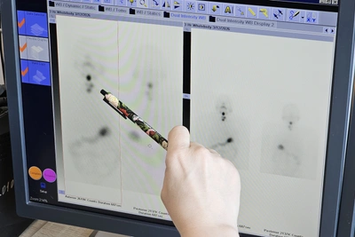 В онкоцентре Хабаровска 72 пациента прошли радиоойодтерапию