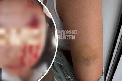 «Необразованных везде хватает»: избиение школьницы в Москве