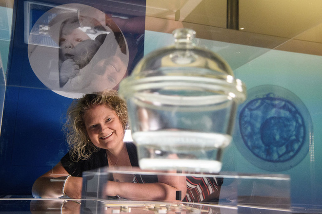 Луиза Браун, первый в мире ребенок из пробирки