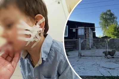 Бездомная собака напала на трёхлетнего мальчика в Кировграде