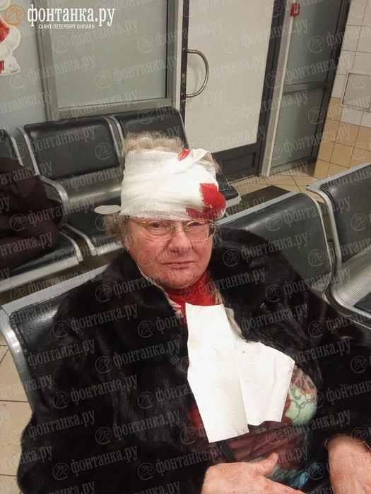 «Бью по руке, чтобы освободила палку». Избивший женщину на Невском рассказал свою версию событий, а она говорит об угрозах | Источник: предоставлено «Фонтанке» пострадавшей