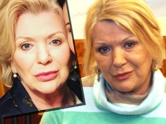Эксперт рассказала, какие процедуры и операции помогли 78-летней Галине Польских заметно помолодеть