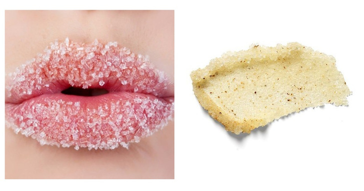 Сухость и шелушения: 10 советов, как защитить губы зимой