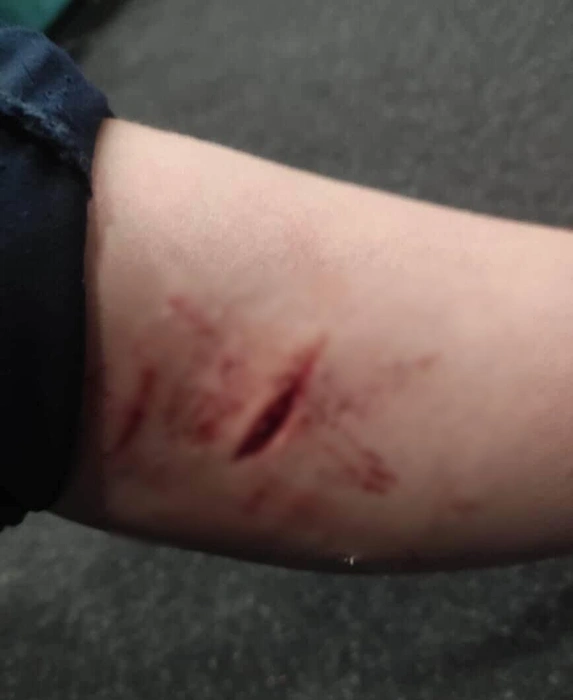 По словам краснодарцев, собаки нападают далеко не в первый раз | Источник: Typicalkrd / T.me