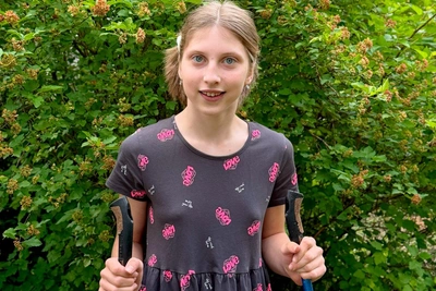 14-летней Тане требуется эндопротезирование сустава