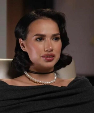«Ликуйте, друзья!»: Алина Загитова сообщила, что уменьшила губы