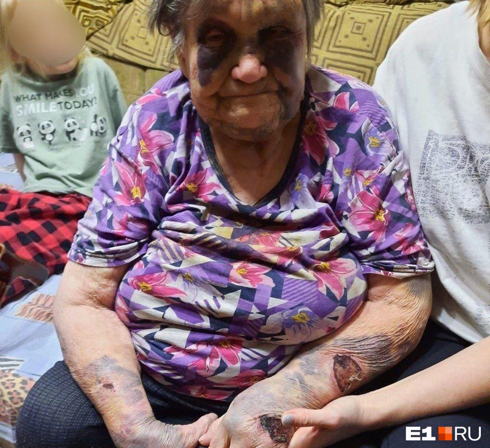 «Била головой об пол, прыгала на спине». Дело 90-летней бабушки, умершей после истязаний, решили «похоронить»