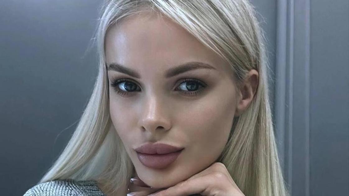 Зверски избитая Тартанова помирилась с возлюбленным, который изувечил ее