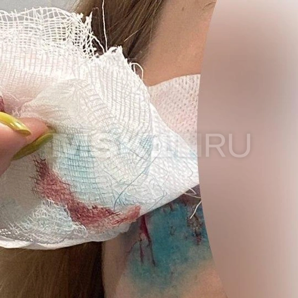 После произошедшего Мария мучилась от головных болей | Источник: предоставлено героиней публикации