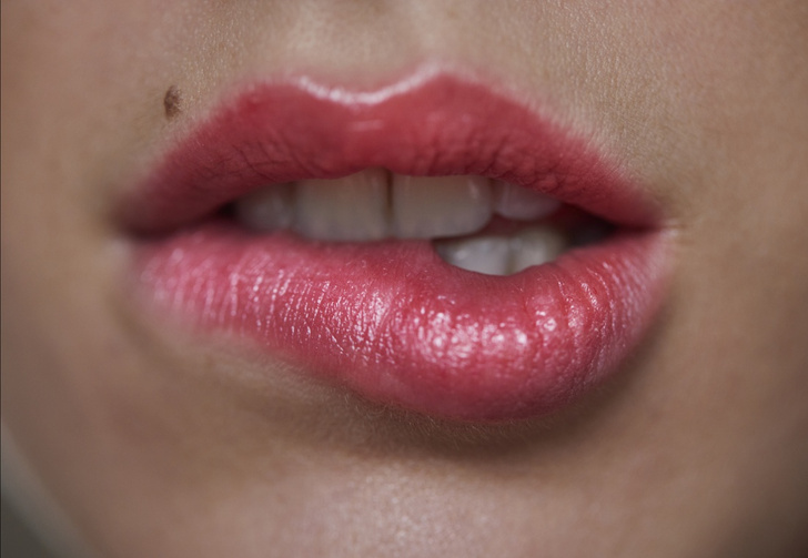 Как устранить заеды на губах: отвечают пользовательницы Woman.ru
