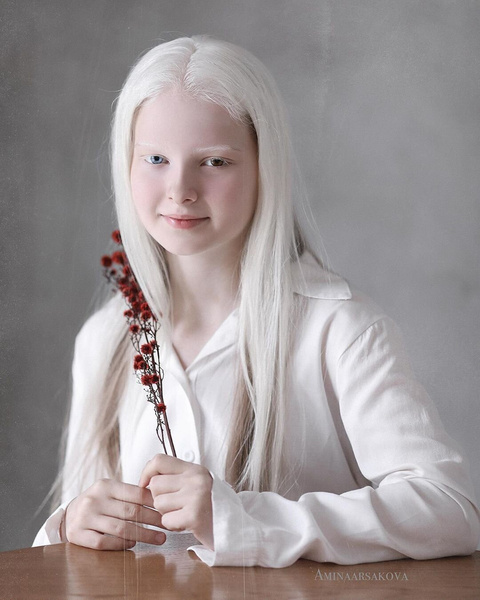 11-летняя девочка-альбинос с гетерохромией из Чечни поражает своей волшебной красотой