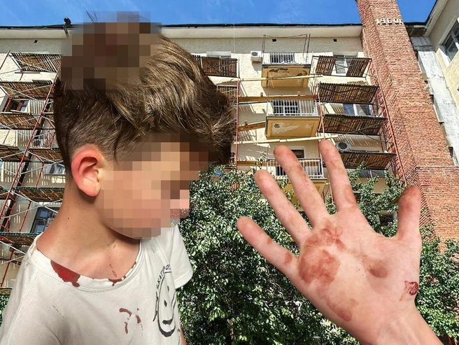 Суд обязал выплатить компенсацию за травмы, полученные ребенком | Источник: Полина Авдошина / Городские медиа
