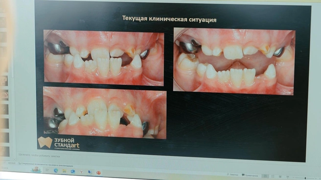 От здоровья зубочелюстной системы зависит и состояние позвоночника, и положение головы в пространстве, и давление, и даже наш слух  | Источник: Михаил Драков