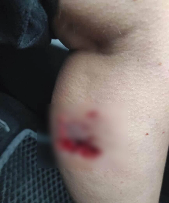 Люди опубликовали фото ран в Сети | Источник: Typicalkrd / T.me