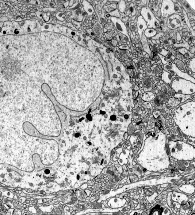 На кадре — слои клеток и синапсов законсервированного свиного мозга | Источник: The Brain Preservation Foundation / MIT Technology Review