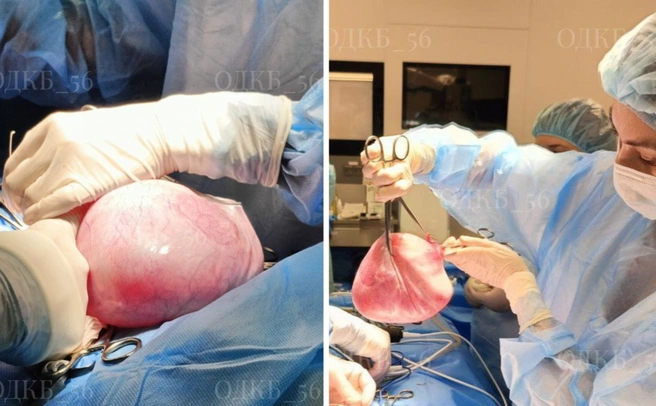 Хирурги из Оренбурга спасли 14-летнюю девочку с огромной опухолью в животе | Источник: ОДКБ 56 (Юлия Шарифуллина) / t.me