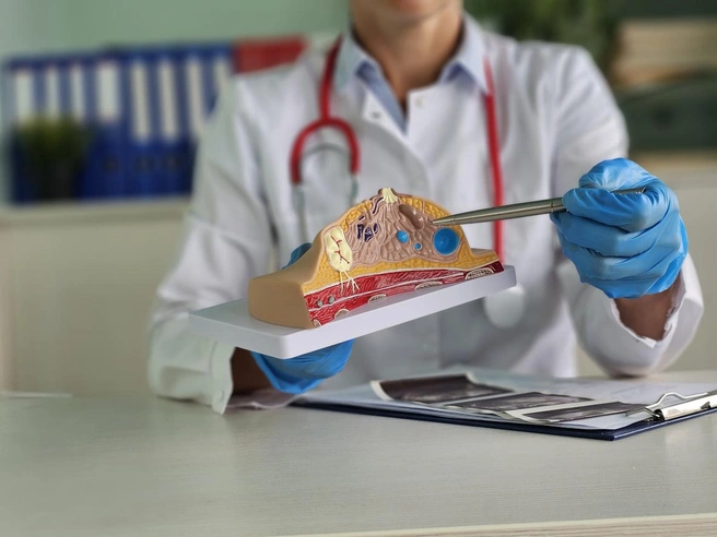 Не упусти момент! Петербургские женщины узнают о симптомах и рисках рака груди | Источник: Nadzeya Haroshka, iStock