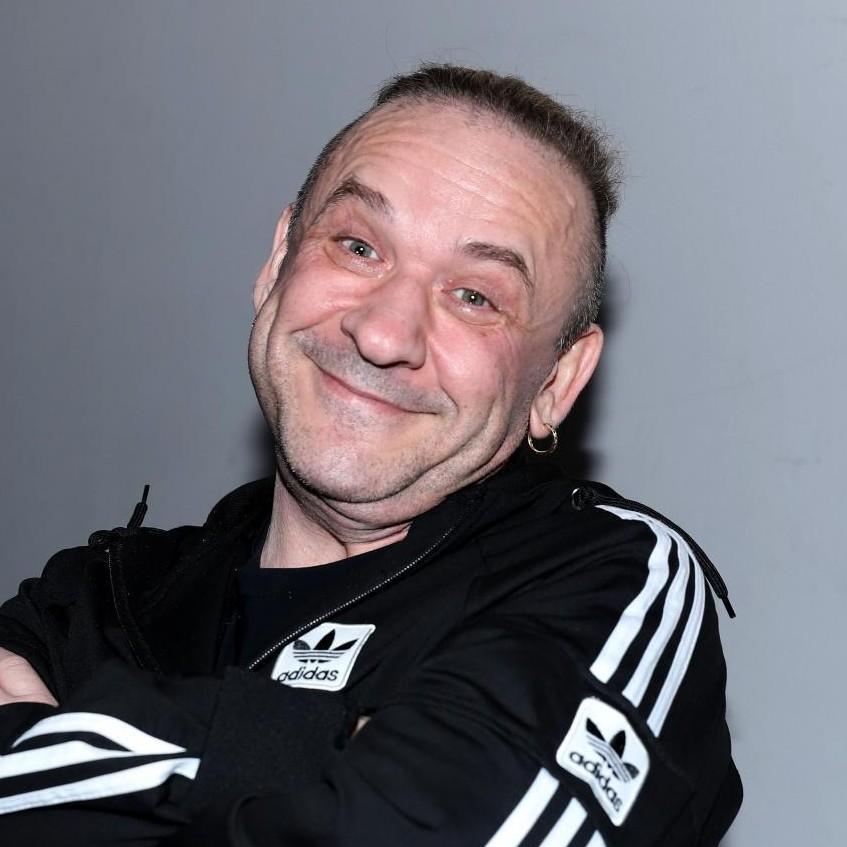 Александр Морозов показал помолодевшее лицо после пластической операции — фото