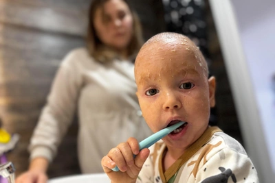 How a boy with ichthyosis lives in Yekaterinburg