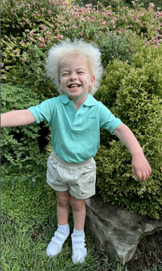 Как выглядит мальчик, у которого выявили редкий синдром нерасчесываемых волос
