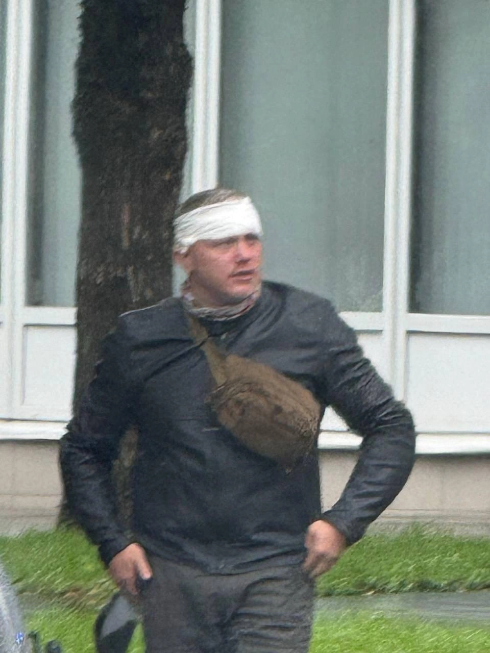 На кадрах с места аварии Алексей с перебинтованной головой  | Источник: Москва 24 / T.me