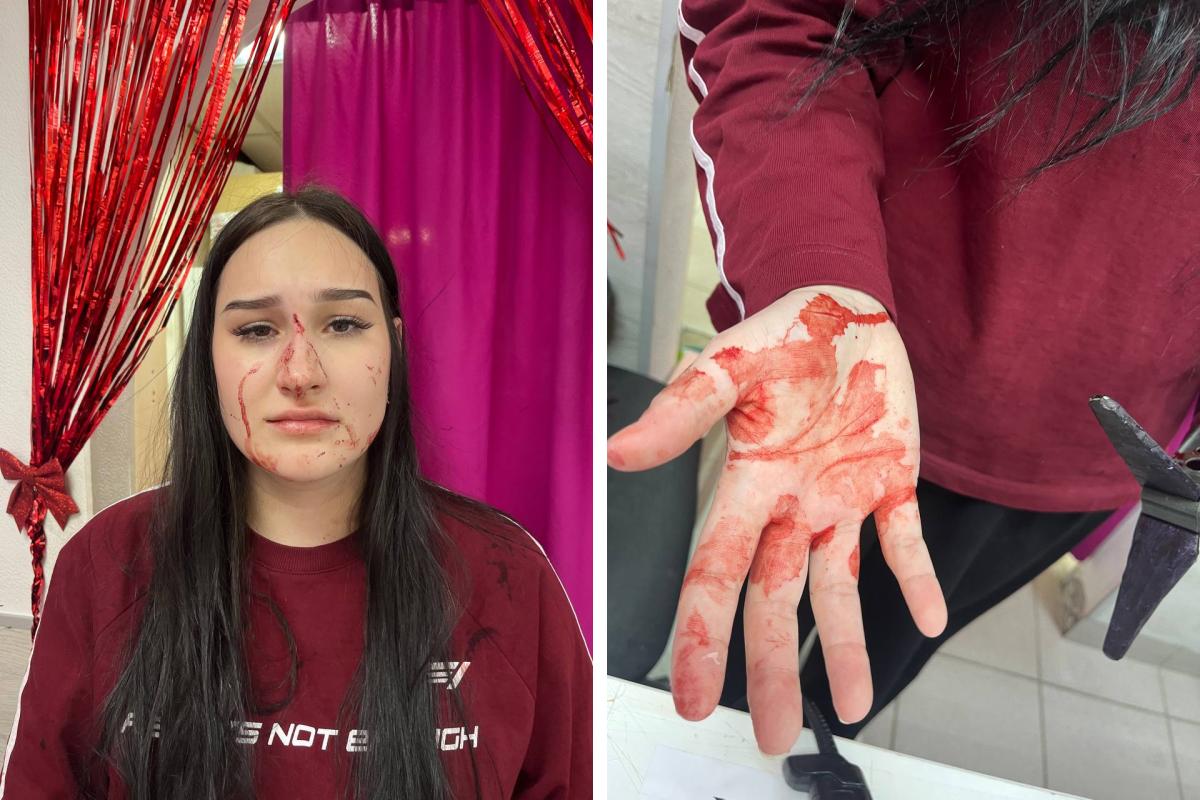 «Я хочу забрать свой товар»: в Перми клиентка избила сотрудницу ПВЗ — ей пришлось зашивать лицо. Видео