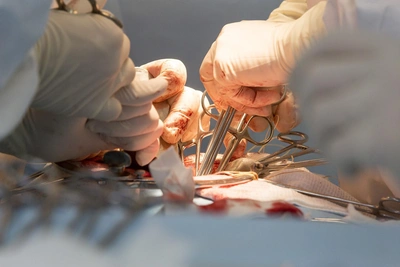 В Барнауле пациенту ошибочно удалили зубы вместо опухоли