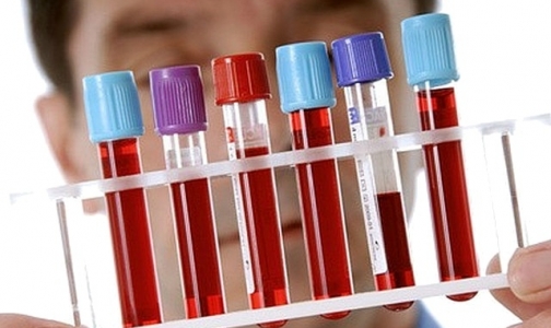Петербургские врачи предлагают сделать обследование на ВИЧ обязательным