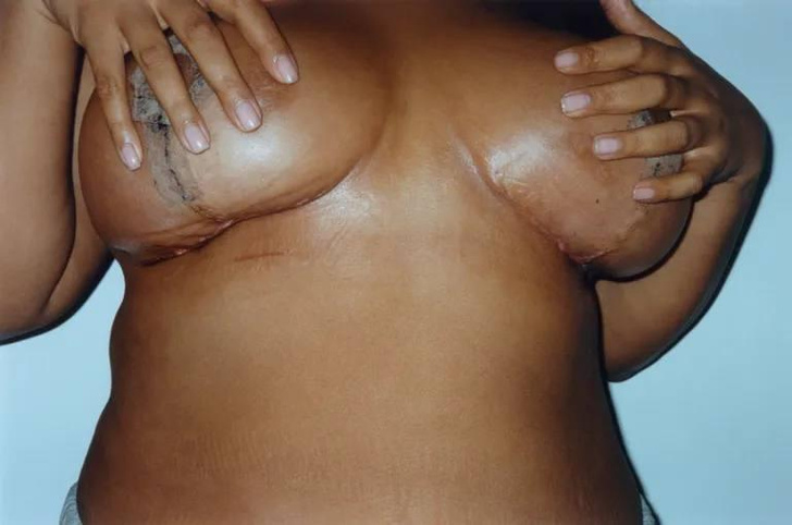Модель Палома Эльсессер уменьшила грудь и сделала из операции искусство