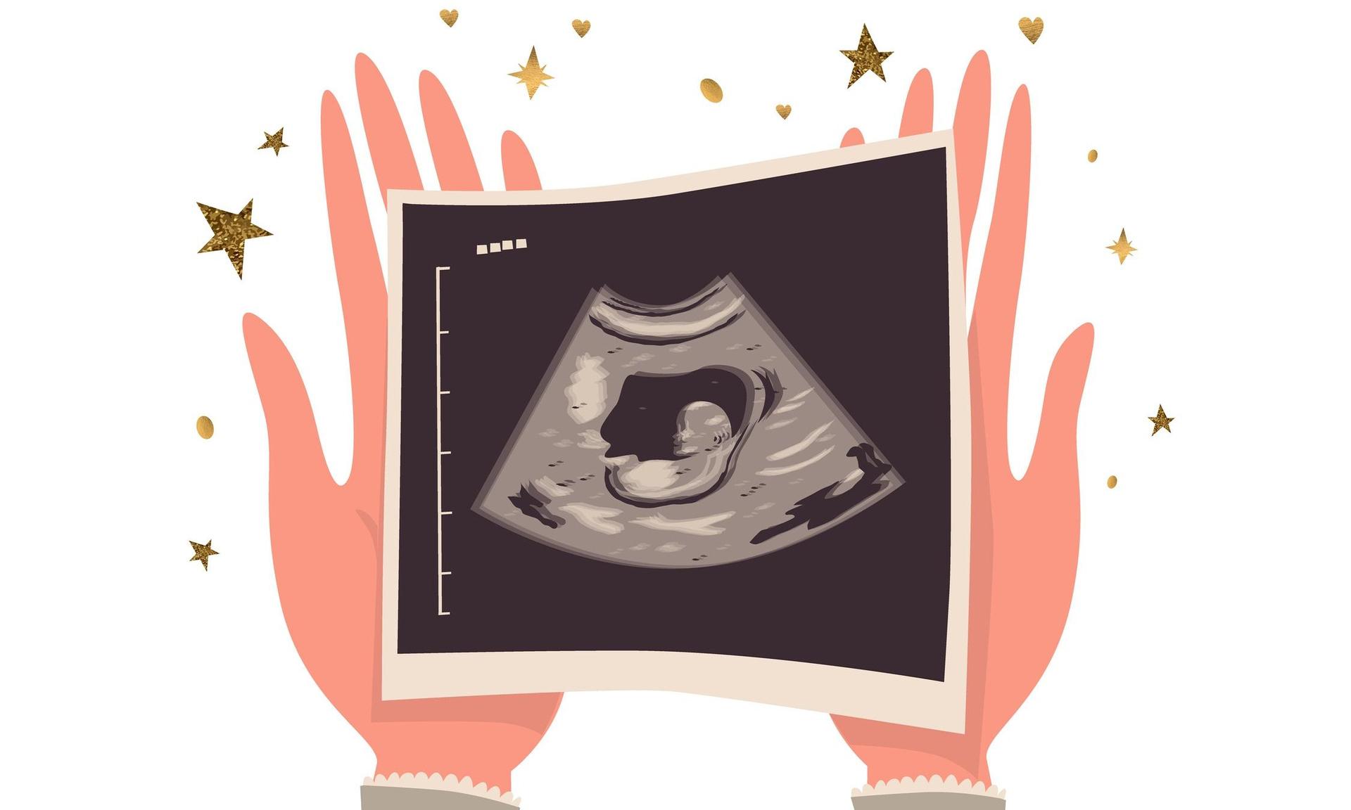 Желтое тело при беременности на ранних сроках патологии
