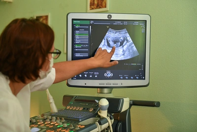 Аборты в Саратовской области сократились на 3%