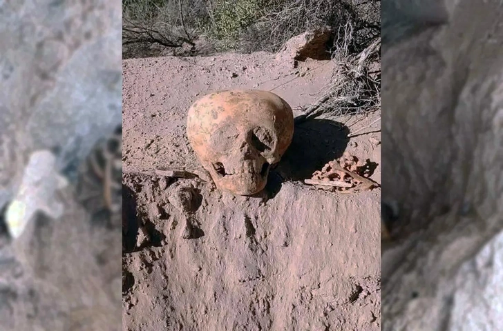 В Аргентине нашли сплющенный человеческий череп. Разумеется, появились версии об инопланетянах | Источник: El Ancasti