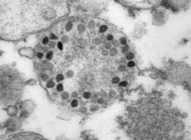 Американский врач назвала главный симптом «омикрона» | ya62.ru