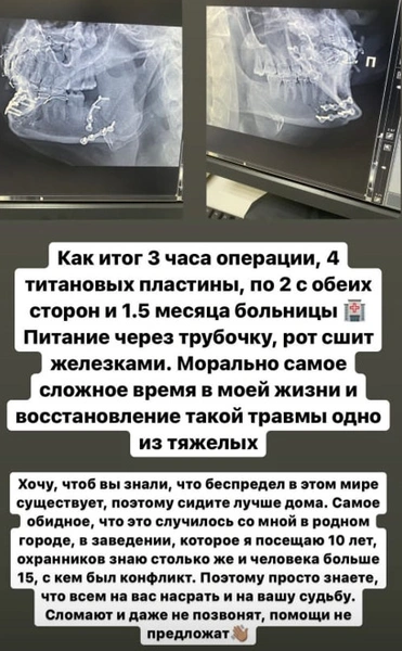 «Рот сшит железками»: звезду «ДОМа-2» Захара Саленко изувечили в клубе