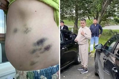 Екатеринбурженку избили за замечание шумным гостям свадьбы