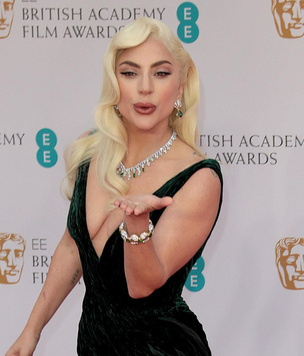 Леди Гага в образе Харли Квинн: первые фото певицы со съемок второго «Джокера» с Хоакином Фениксом