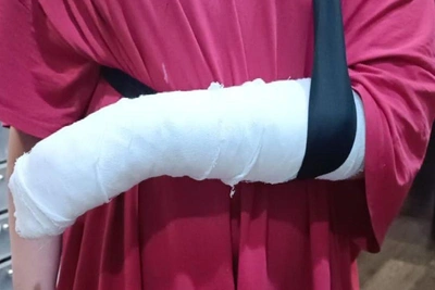 Школьнице с переломом отказали в вызове скорой