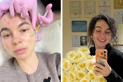 Дело о нападении на королеву красоты в Казани приостановлено